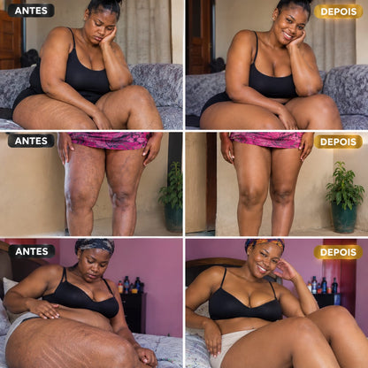 🥰CREME BORBOLETA DA TREE CITY-ANTI-ESTRIAS E VARIZES🥰