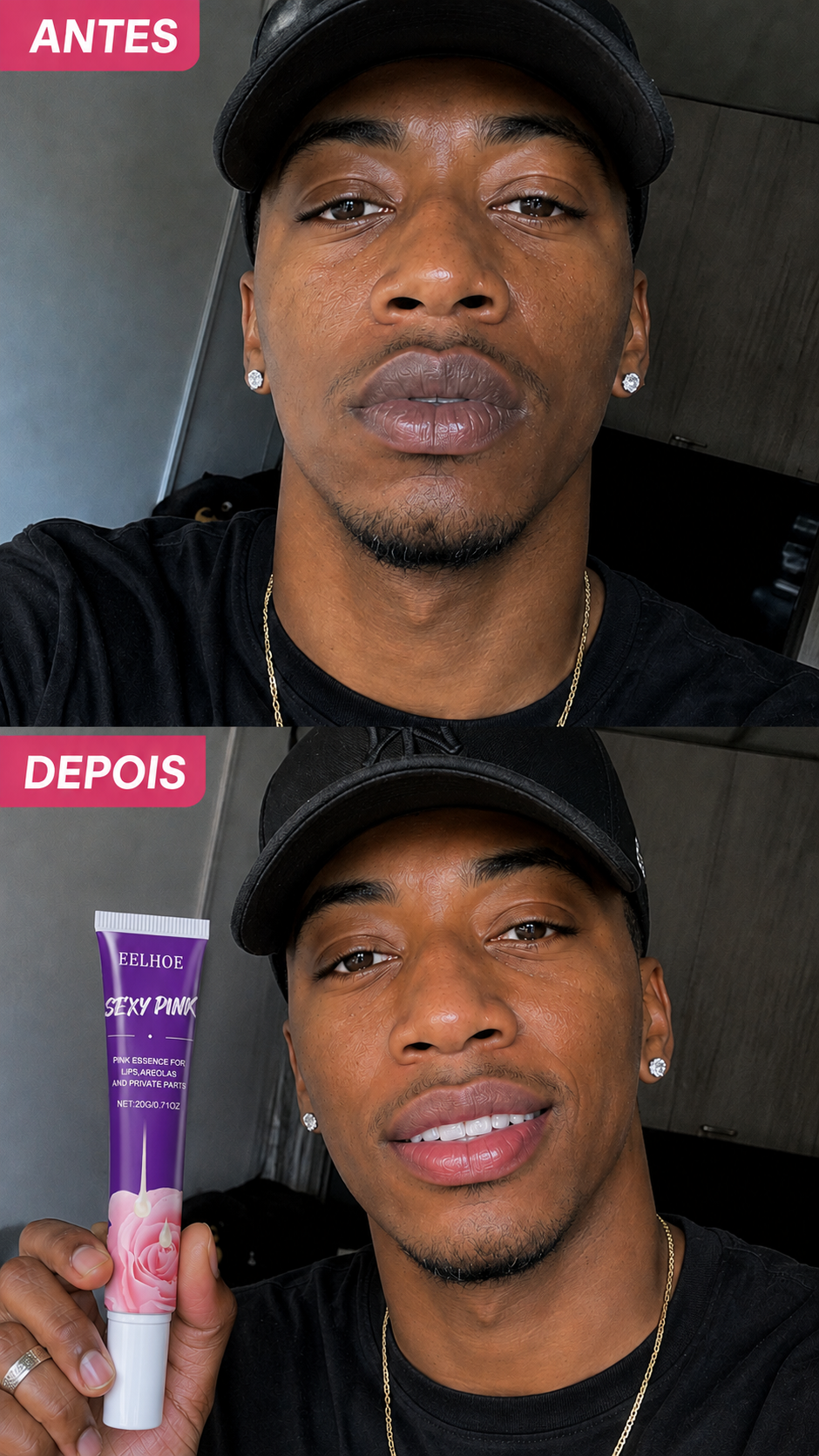 🥰SEXY PINK DA EELHOE-Clareador Multifuncional de Labios e Partes Intimas!🥰