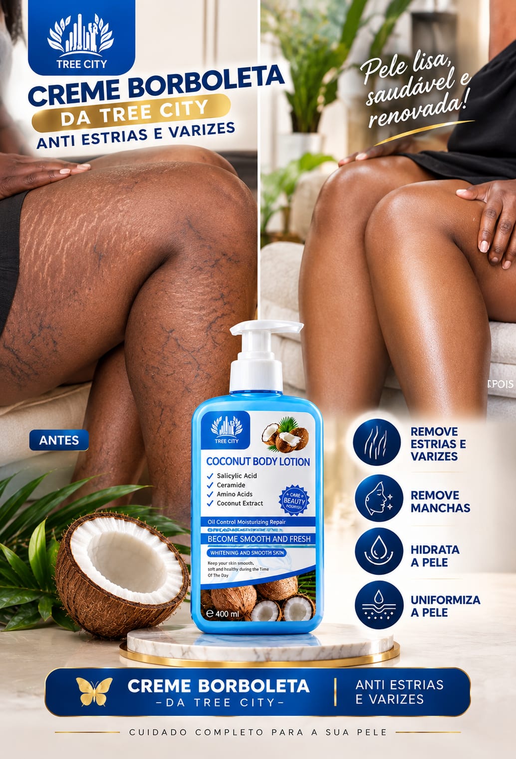 🥰CREME BORBOLETA DA TREE CITY-ANTI-ESTRIAS E VARIZES🥰