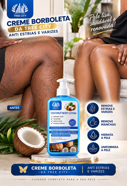 🥰CREME BORBOLETA DA TREE CITY-ANTI-ESTRIAS E VARIZES🥰