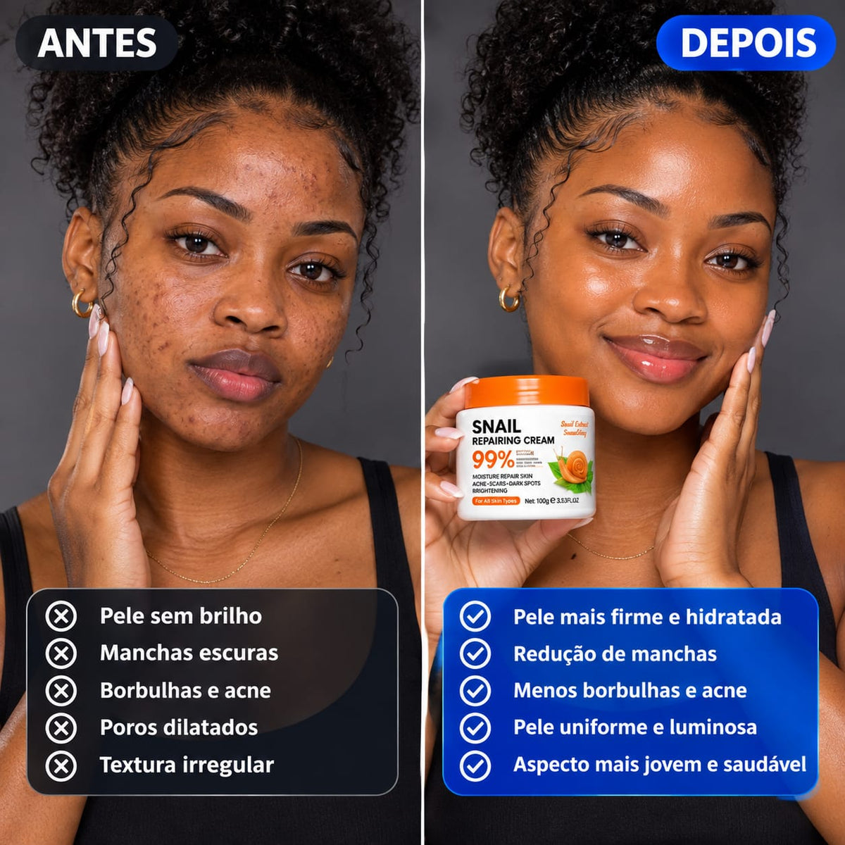 😍CREME DE CARACOL SNAIL REPAIRING-TRIPLA AÇÃO😍