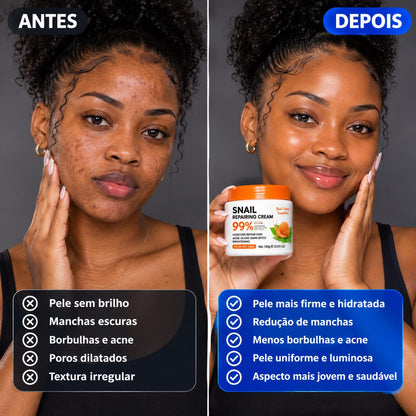 😍CREME DE CARACOL SNAIL REPAIRING-TRIPLA AÇÃO😍