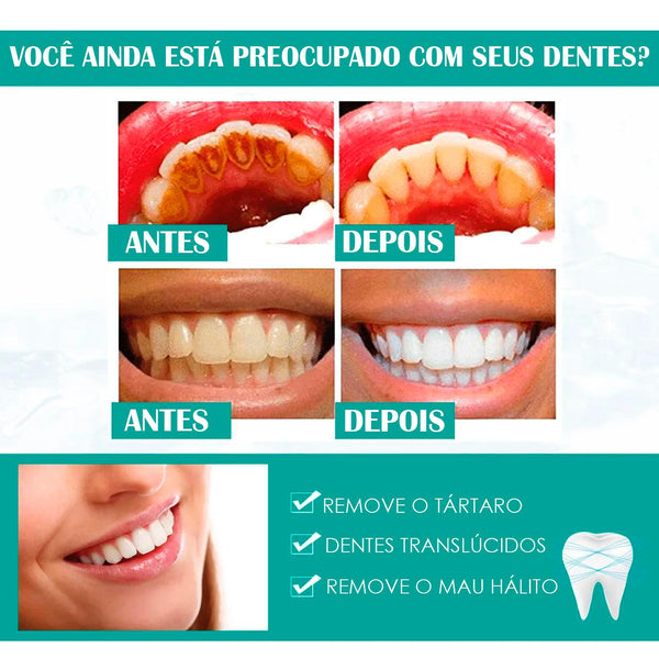Clareador Dental(Dentes brancos em 5 Dias🔥)