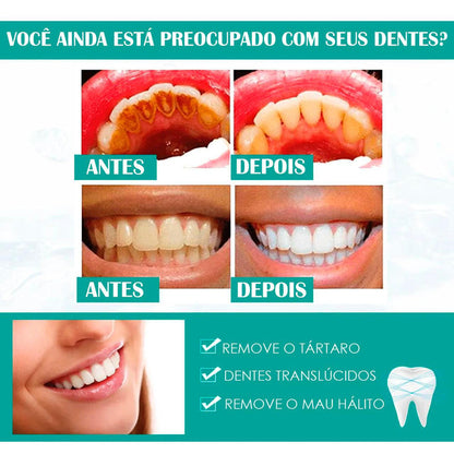 Clareador Dental(Dentes brancos em 5 Dias🔥)