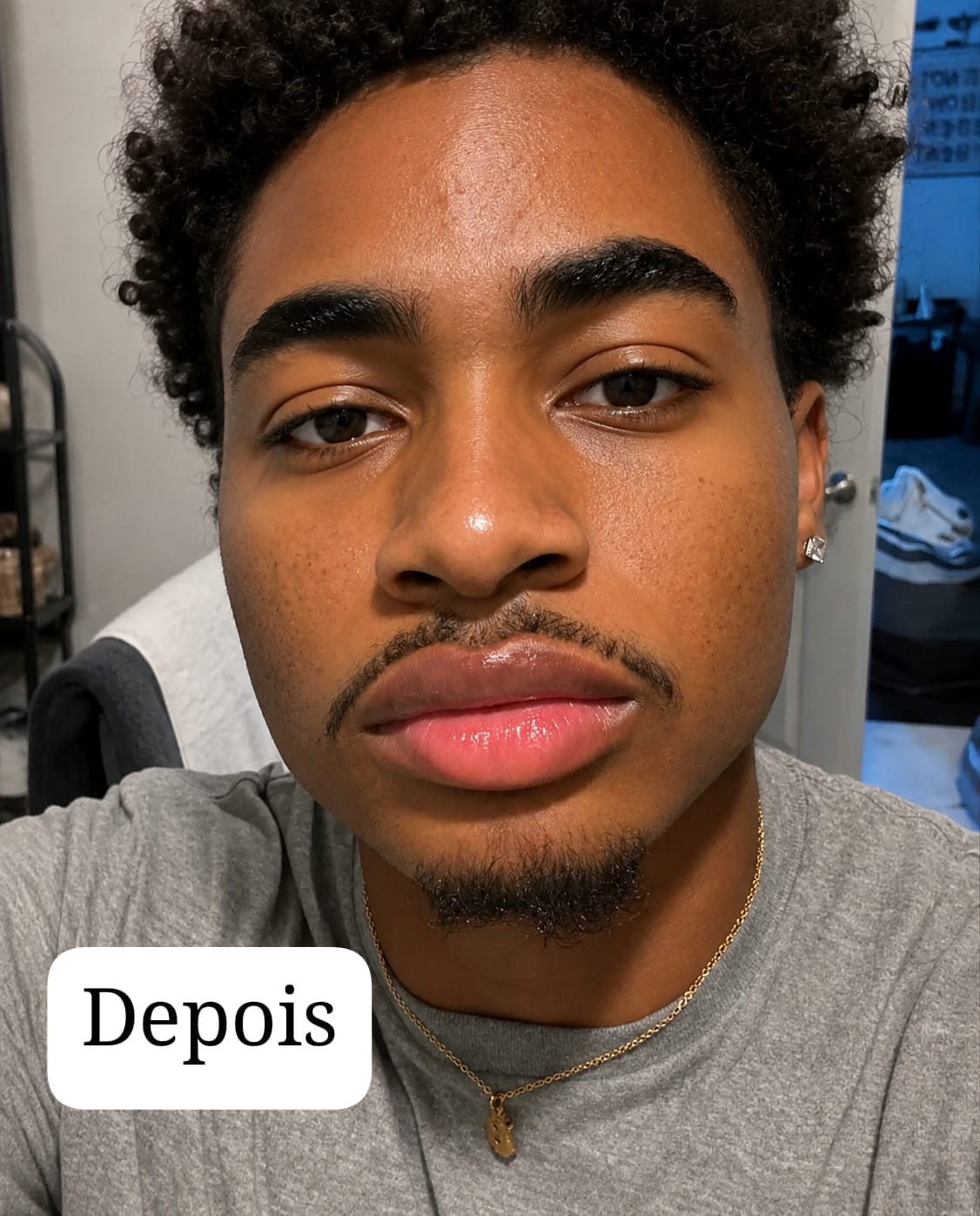🥰SEXY PINK DA EELHOE-Clareador Multifuncional de Labios e Partes Intimas!🥰
